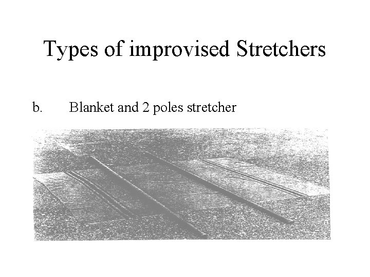 Types of improvised Stretchers b. Blanket and 2 poles stretcher 