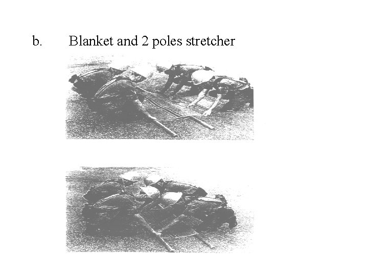 b. Blanket and 2 poles stretcher 