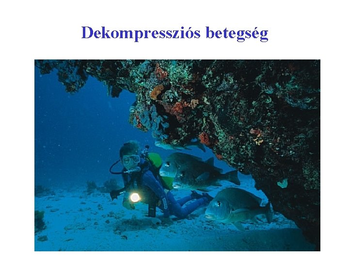 Dekompressziós betegség 