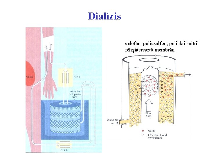 Dialízis celofán, poliszulfon, poliakril-nitril féligáteresztő membrán 