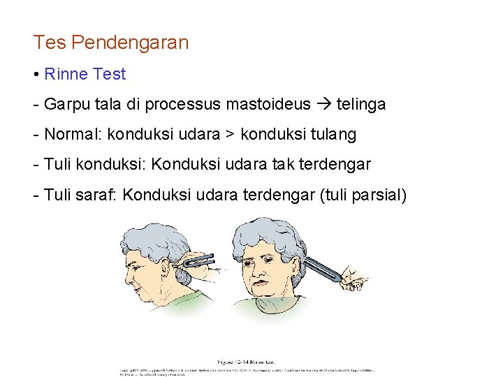 Tes Pendengaran • Rinne Test - Garpu tala di processus mastoideus telinga - Normal: