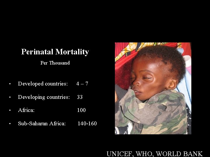 Perinatal Mortality Per Thousand • Developed countries: 4– 7 • Developing countries: 33 •