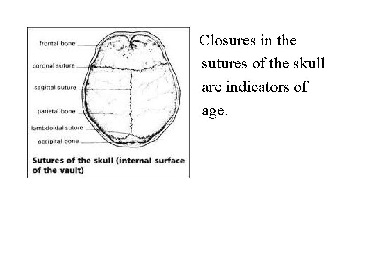  • Closures in the sutures of the skull are indicators of age. 