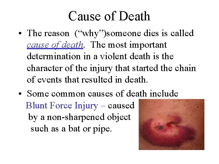 Cause of Death • The reason (“why”)someone dies is called cause of death. The