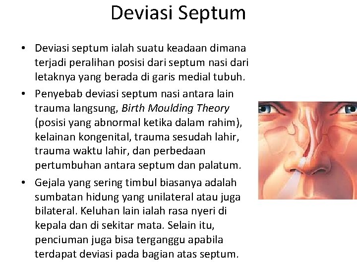 Deviasi Septum • Deviasi septum ialah suatu keadaan dimana terjadi peralihan posisi dari septum