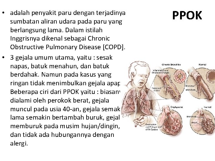  • adalah penyakit paru dengan terjadinya sumbatan aliran udara pada paru yang berlangsung