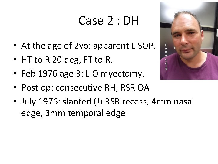 Case 2 : DH • • • At the age of 2 yo: apparent