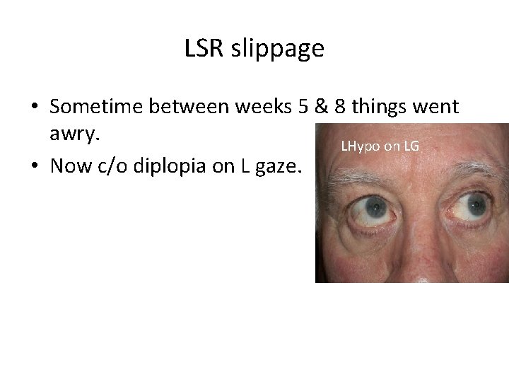 LSR slippage • Sometime between weeks 5 & 8 things went awry. LHypo on