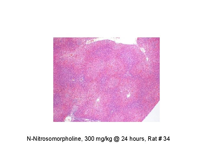 N-Nitrosomorpholine, 300 mg/kg @ 24 hours, Rat # 34 