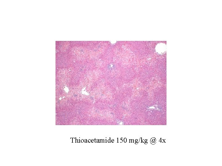 Thioacetamide 150 mg/kg @ 4 x 