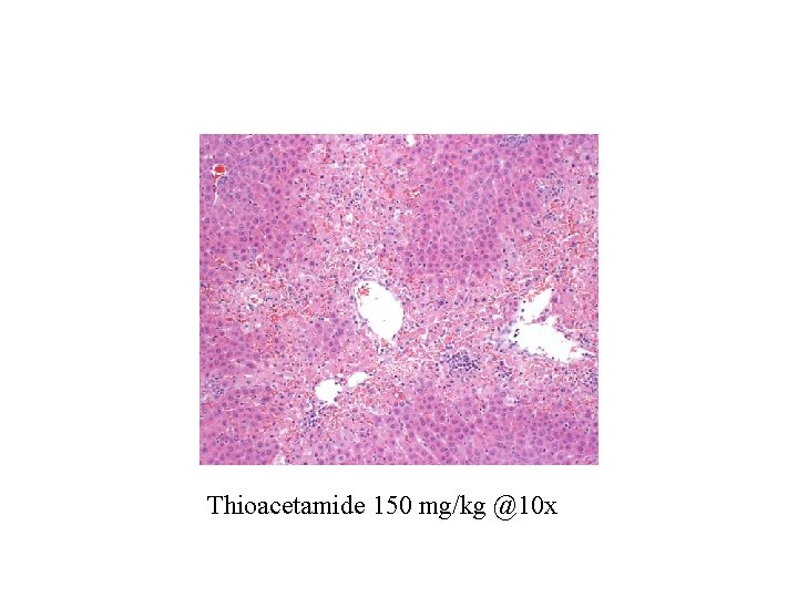 Thioacetamide 150 mg/kg @10 x 