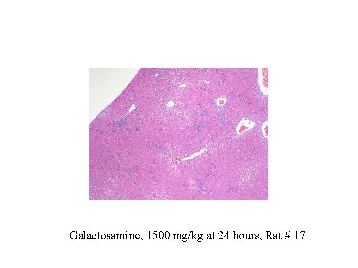 Galactosamine, 1500 mg/kg at 24 hours, Rat # 17 