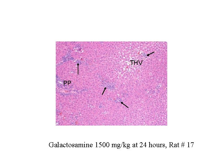THV PP Galactosamine 1500 mg/kg at 24 hours, Rat # 17 