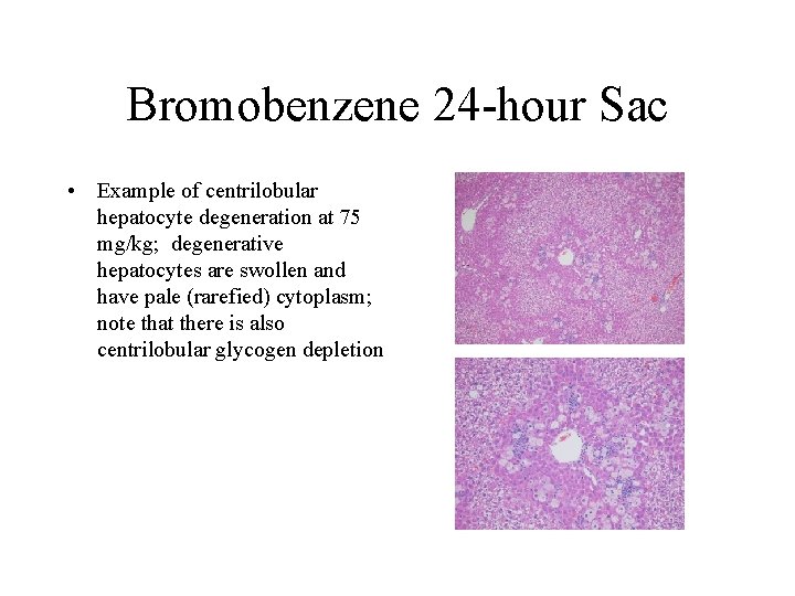 Bromobenzene 24 -hour Sac • Example of centrilobular hepatocyte degeneration at 75 mg/kg; degenerative