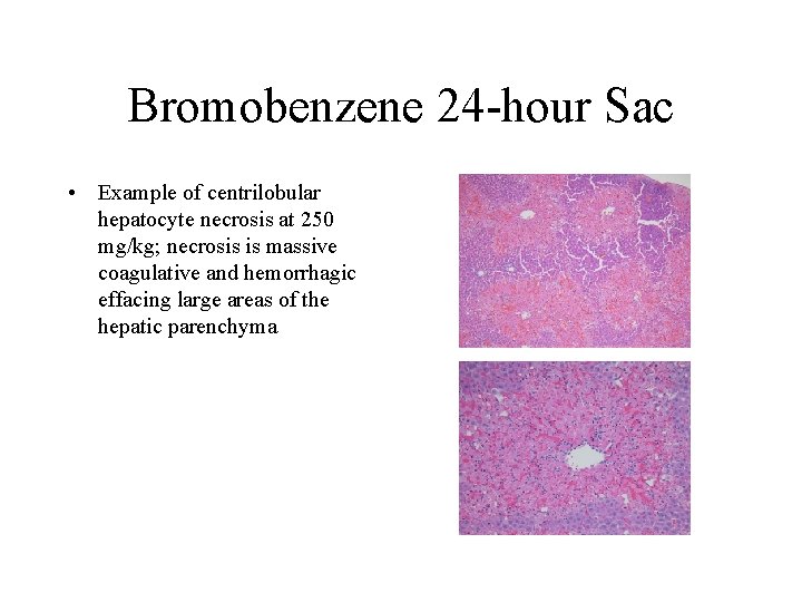 Bromobenzene 24 -hour Sac • Example of centrilobular hepatocyte necrosis at 250 mg/kg; necrosis
