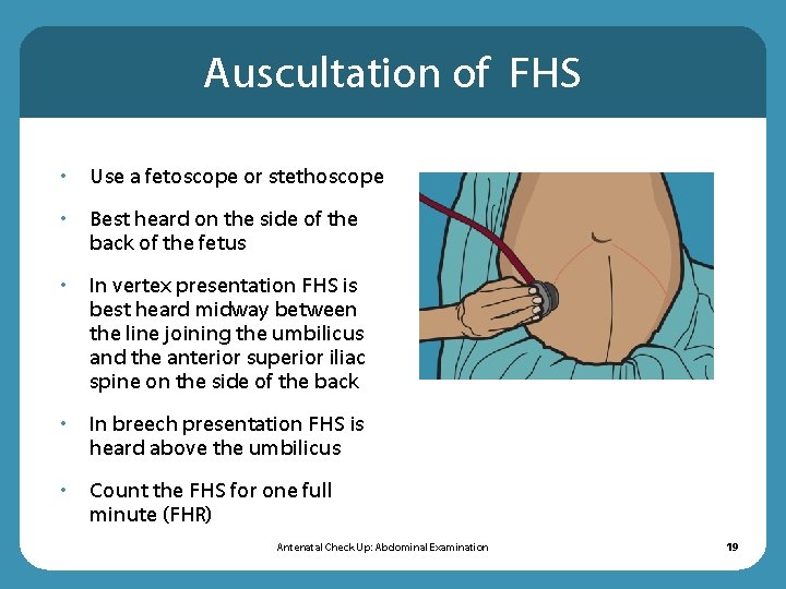 Auscultation of FHS • Use a fetoscope or stethoscope • Best heard on the