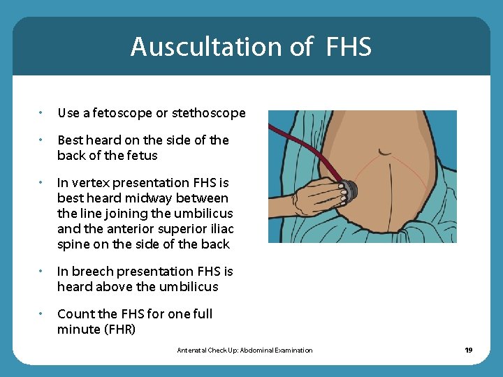 Auscultation of FHS • Use a fetoscope or stethoscope • Best heard on the Auscultation of FHS • Use a fetoscope or stethoscope • Best heard on the