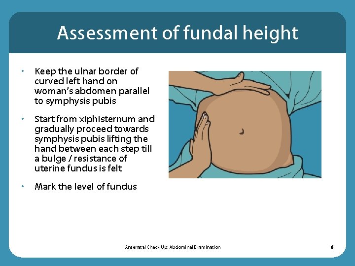 Assessment of fundal height • Keep the ulnar border of curved left hand on Assessment of fundal height • Keep the ulnar border of curved left hand on