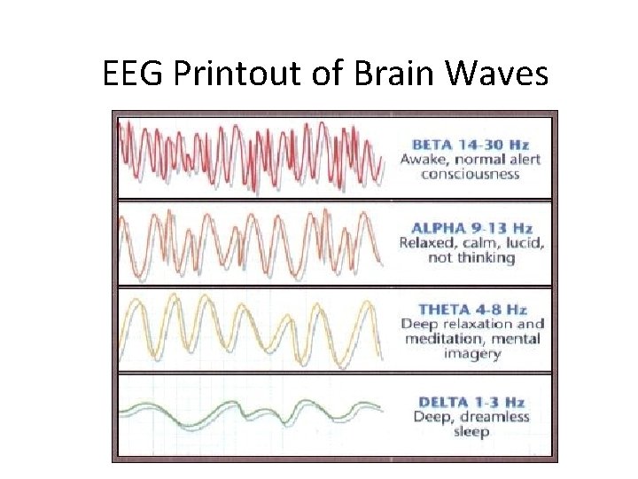 EEG Printout of Brain Waves 