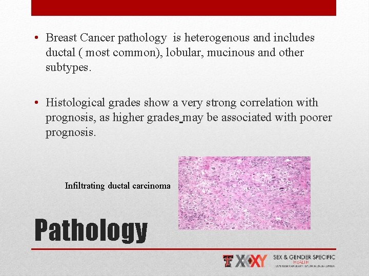  • Breast Cancer pathology is heterogenous and includes ductal ( most common), lobular,