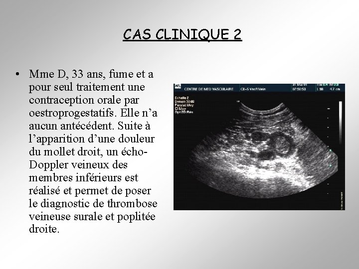 CAS CLINIQUE 2 • Mme D, 33 ans, fume et a pour seul traitement