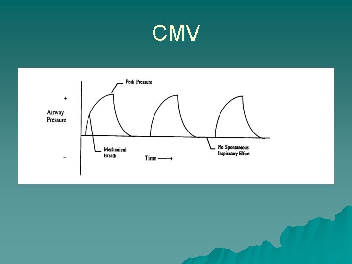 CMV 