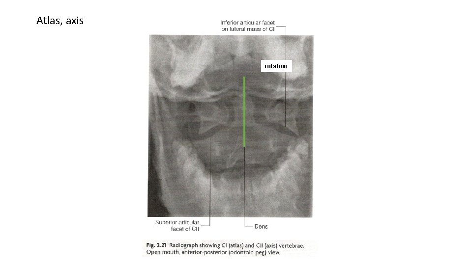 Atlas, axis rotation 