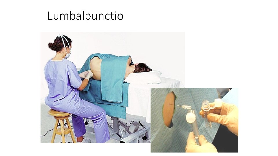 Lumbalpunctio 