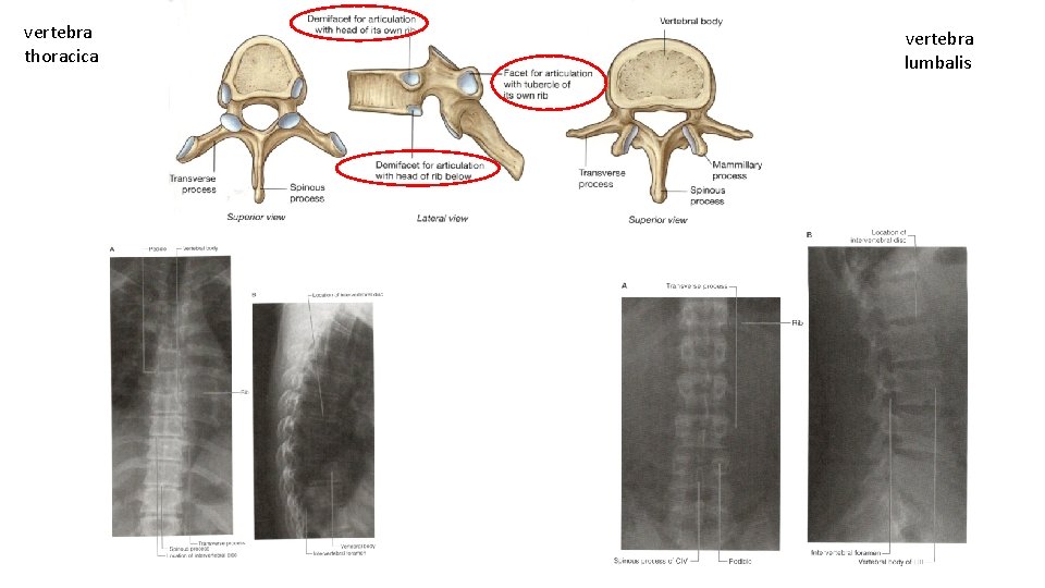 vertebra thoracica vertebra lumbalis 