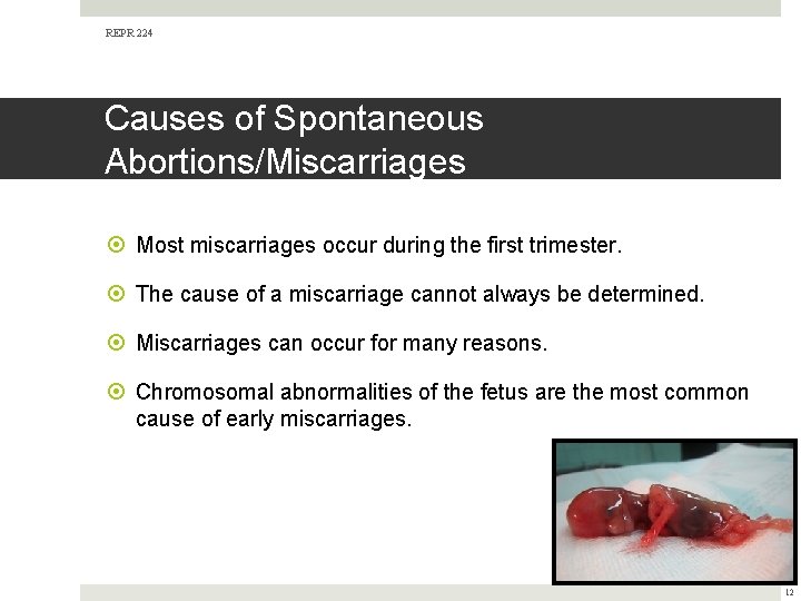 REPR 224 Causes of Spontaneous Abortions/Miscarriages Most miscarriages occur during the first trimester. The