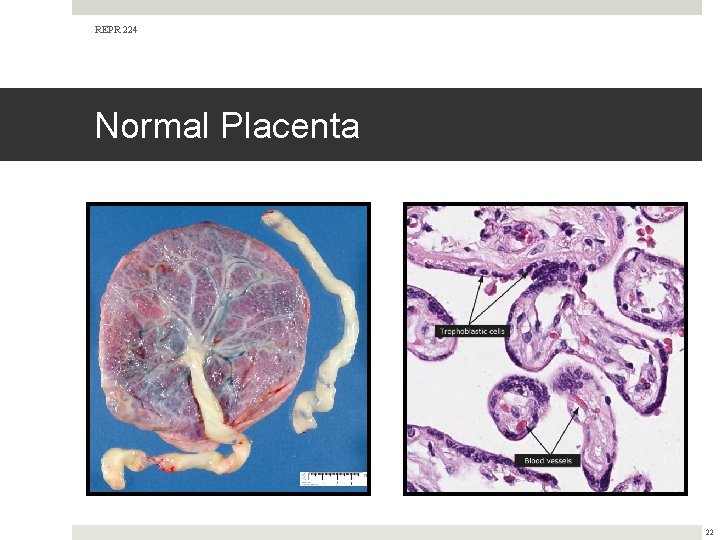 REPR 224 Normal Placenta 22 