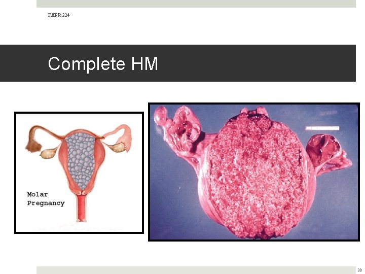 REPR 224 Complete HM 30 