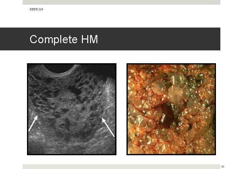 REPR 224 Complete HM 32 