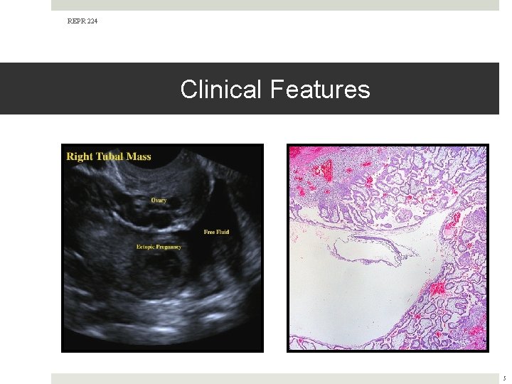 REPR 224 Clinical Features 5 