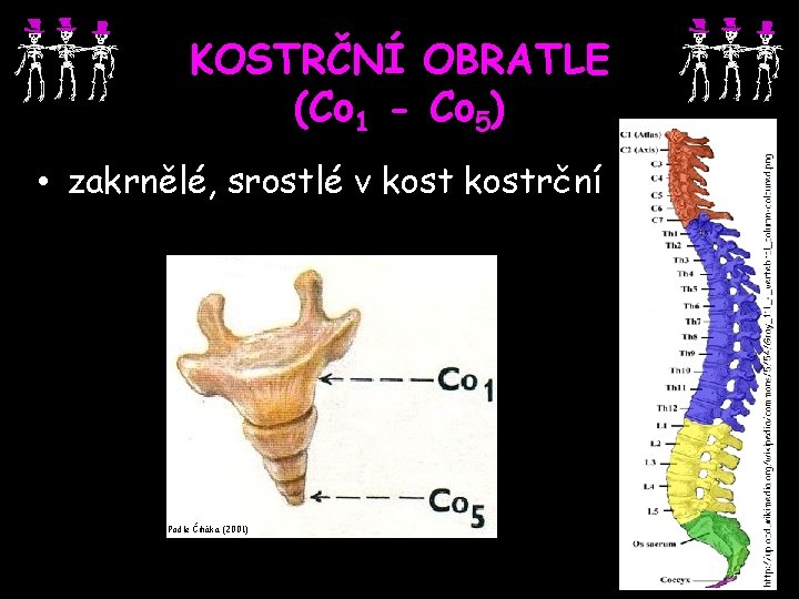 KOSTRČNÍ OBRATLE (Co 1 - Co 5) • zakrnělé, srostlé v kostrční Podle Čiháka