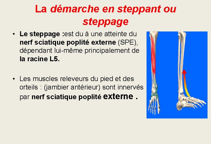 La démarche en steppant ou steppage • Le steppage : est du à une La démarche en steppant ou steppage • Le steppage : est du à une