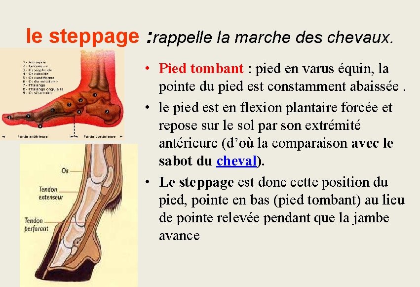 le steppage : rappelle la marche des chevaux. • Pied tombant : pied en le steppage : rappelle la marche des chevaux. • Pied tombant : pied en