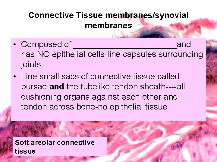 Connective Tissue membranes/synovial membranes • Composed of ___________and has NO epithelial cells-line capsules surrounding