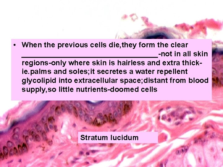  • When the previous cells die, they form the clear _________________-not in all