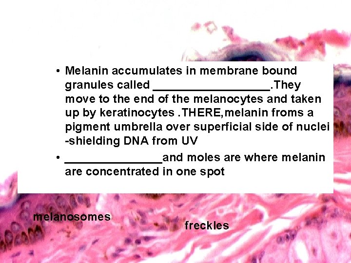  • Melanin accumulates in membrane bound granules called _________. They move to the