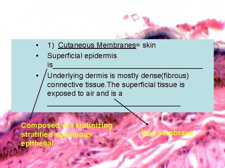  • • • 1) Cutaneous Membranes= skin Superficial epidermis is__________________ Underlying dermis is