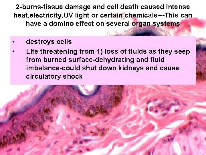 2 -burns-tissue damage and cell death caused intense heat, electricity, UV light or certain