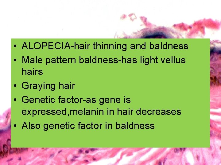  • ALOPECIA-hair thinning and baldness • Male pattern baldness-has light vellus hairs •