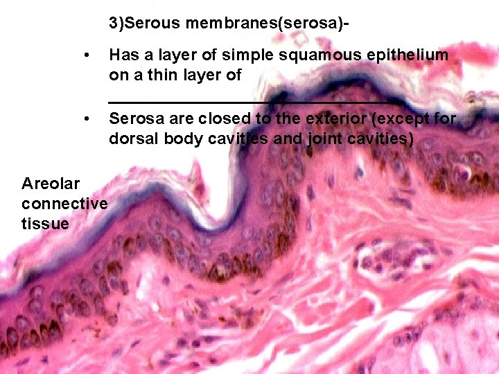 3)Serous membranes(serosa)- • • Areolar connective tissue Has a layer of simple squamous epithelium