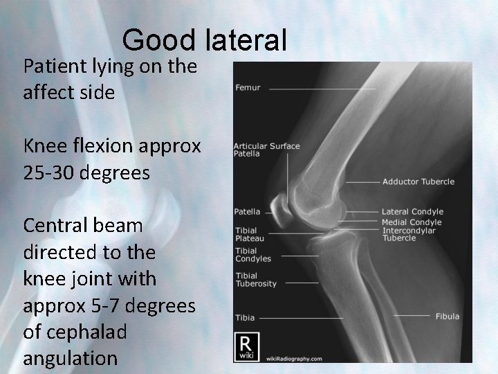 Good lateral Patient lying on the affect side Knee flexion approx 25 -30 degrees