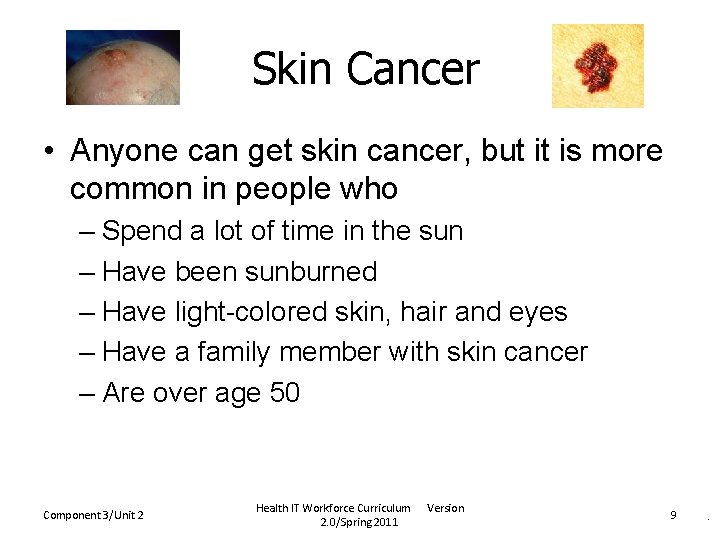 Skin Cancer • Anyone can get skin cancer, but it is more common in