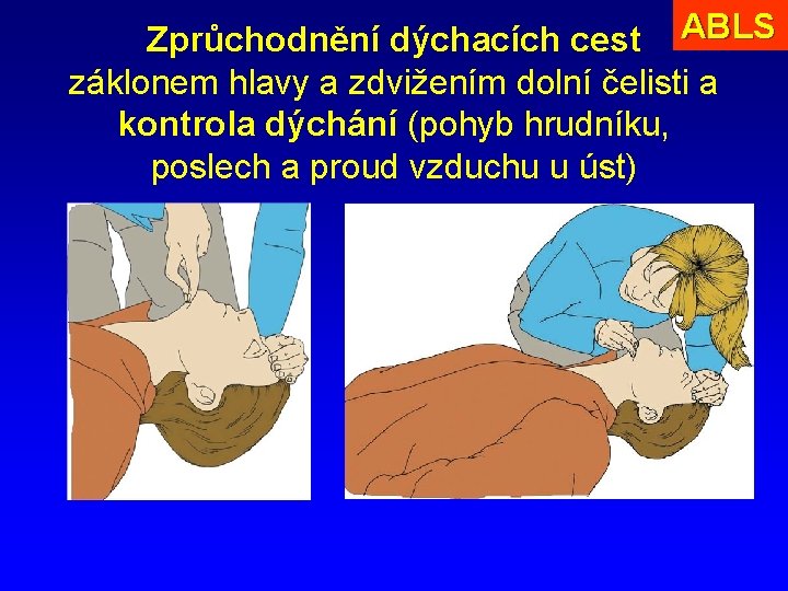 Zprůchodnění dýchacích cest ABLS záklonem hlavy a zdvižením dolní čelisti a kontrola dýchání (pohyb