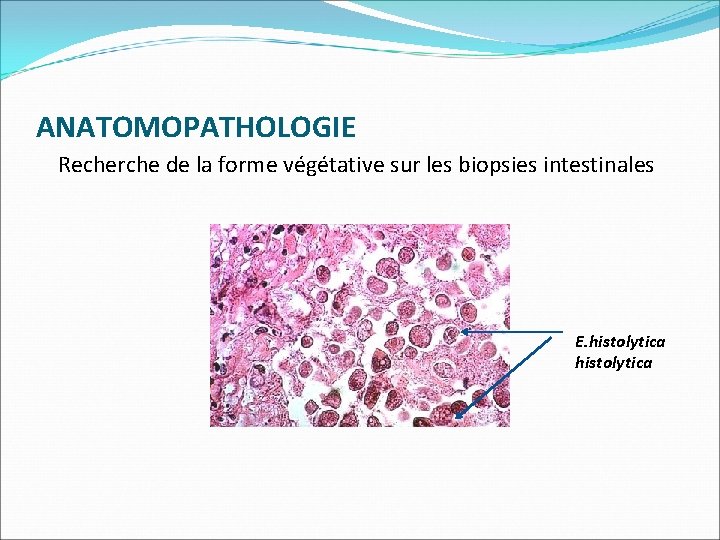 ANATOMOPATHOLOGIE Recherche de la forme végétative sur les biopsies intestinales E. histolytica 