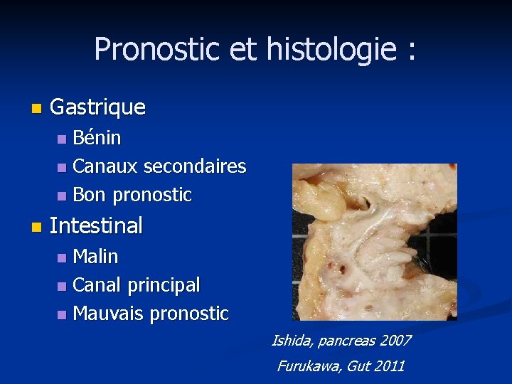 Pronostic et histologie : n Gastrique Bénin n Canaux secondaires n Bon pronostic n