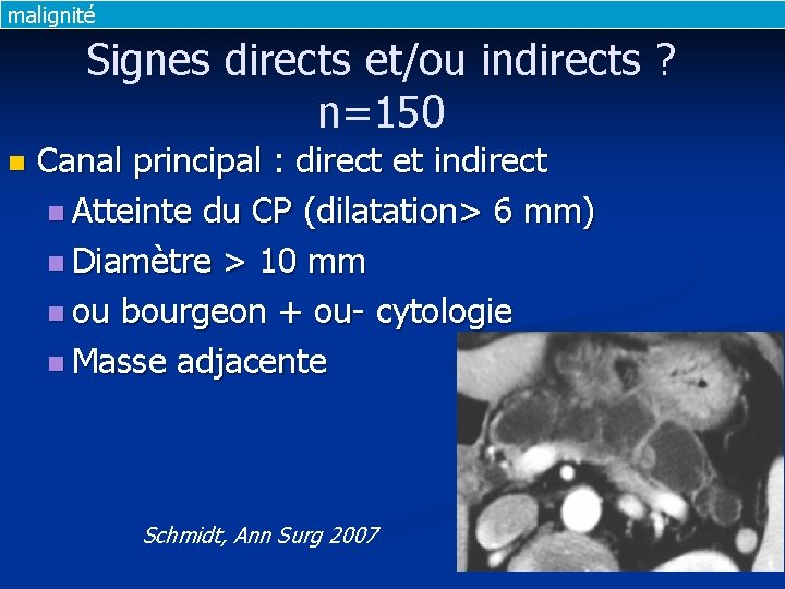 malignité Signes directs et/ou indirects ? n=150 n Canal principal : direct et indirect
